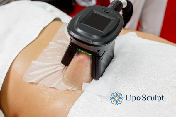 Does Fat Freezing at Home Work? DIY Devices vs Professional Cryolipolysis 1 How is professional cryolipolysis different Worcestershire?